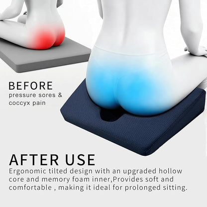 Gel Wheelchair Seat Cushion,Bed Sore Cushions for Butt,hemorrhoid pillow for Chair,Pressure Sore cushion,Memory Foam Butt Pillow,Sciatica,Coccyx,Pressure Ulcer Pain Relief,Washable Cover(Blue)